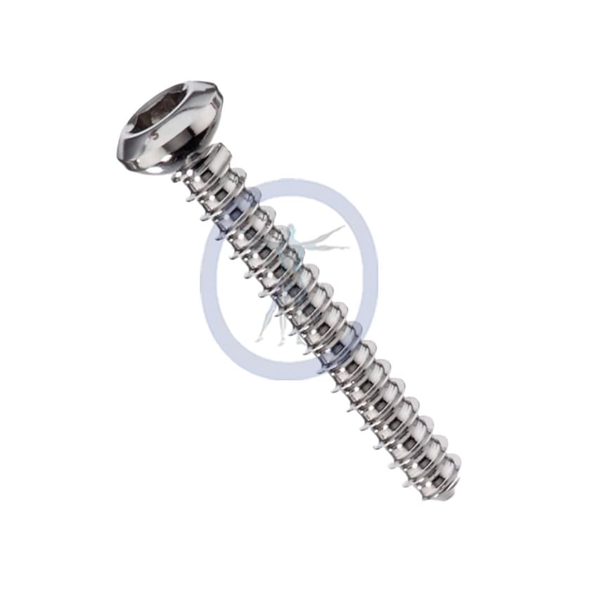 A picture of the side view of a screw.