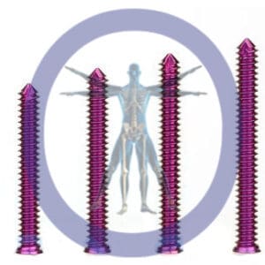 Four purple surgical screws of different sizes.