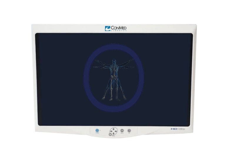 A Conmed-VP4623 23″ HD Flat Panel Monitor displaying a digital x-ray image of a human skeleton with arms outstretched, encircled in blue on a dark screen.