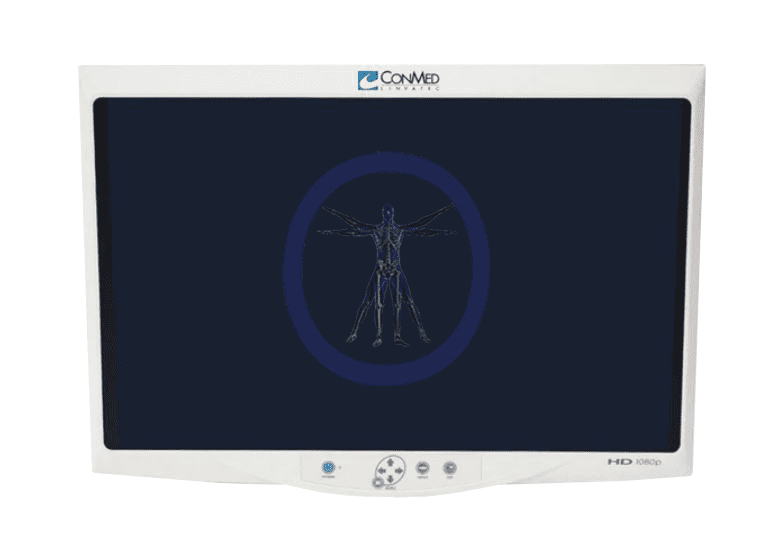 A Conmed-VP4726 26" HD Flat Panel Monitor displaying a blue-toned x-ray image of a human skeleton with arms extended, housed in a white frame with Conmed branding.