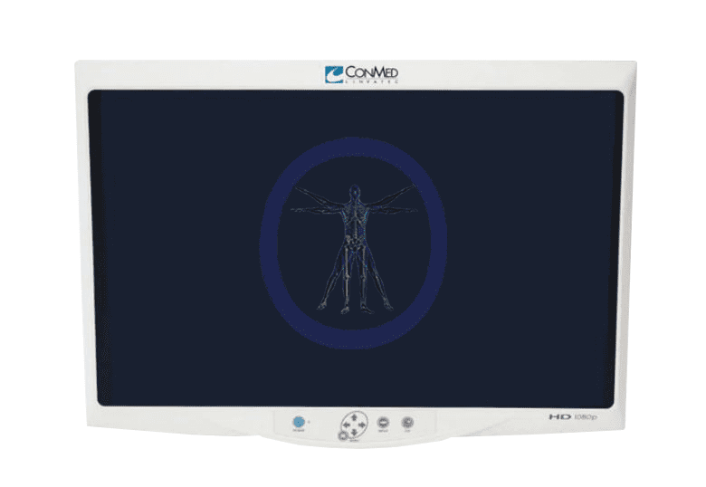 A Conmed-VP4732 32″ HD Flat Panel Monitor displaying a digital skeletal image of a human body in a vitruvian man pose, encircled in blue.