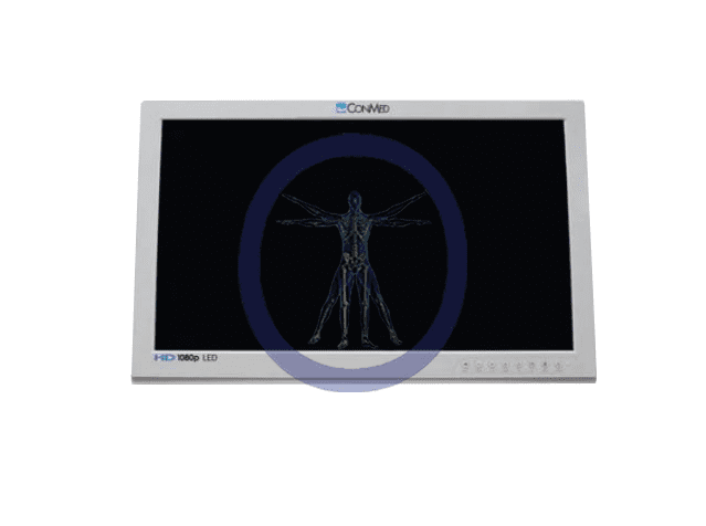 A Conmed-VP4826 26" HD Flat Panel Monitor displaying a digital x-ray image of a human skeleton.