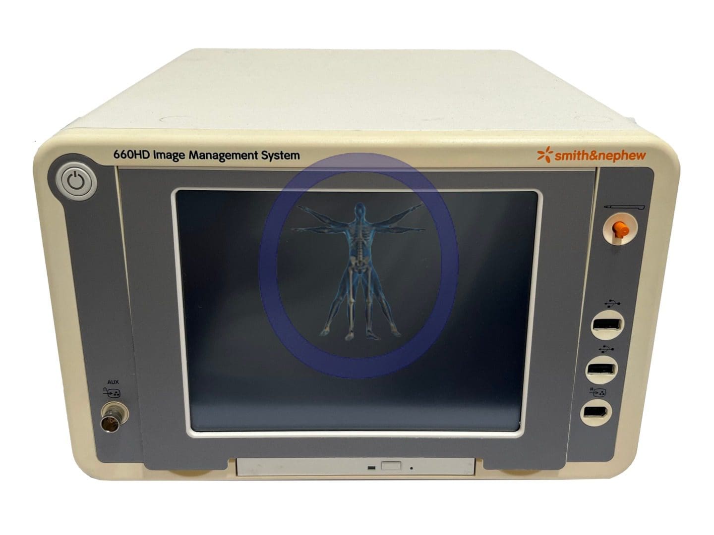 An image of a Smith & Nephew 72200242 660HD Image Management System, a medical device displaying a skeletal scan on its screen.