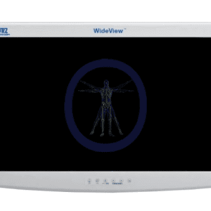A KarlStorz-9424HDAF 24″ HD Flat Panel Monitor displaying a digital blue x-ray image of a human skeleton with outstretched arms.