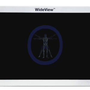 An x-ray image of a human body displayed on a KarlStorz-SC-WU42-A1A15 42″ WideView Flat Panel Surgical Monitor.