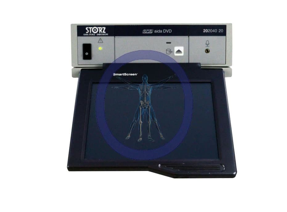 A Karl Storz 20204020 AIDA DVD Image Management System with a display showing a skeletal human figure, has an integrated dvd drive labeled "storz", and a component named "smartscreen".