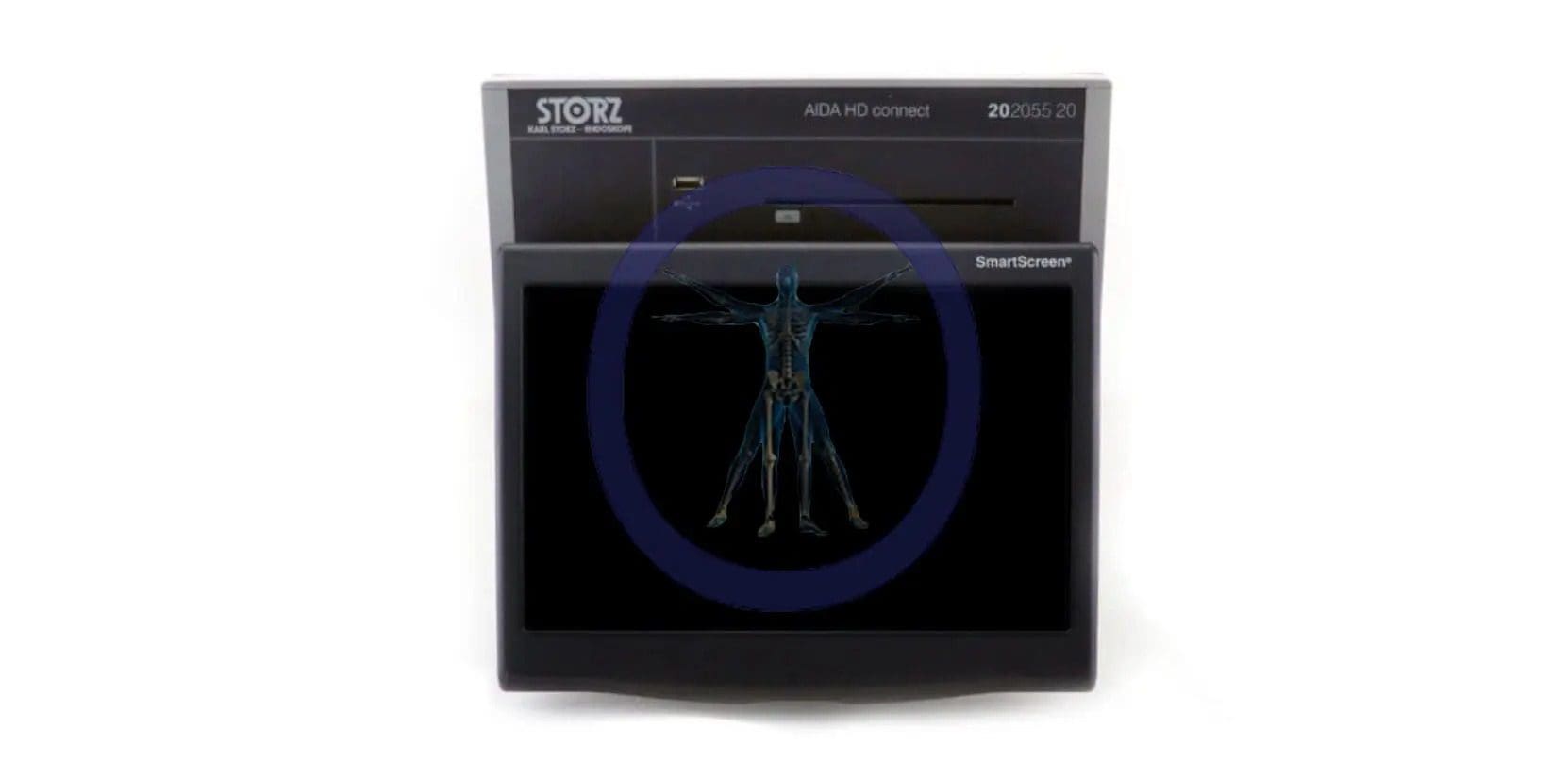 A Karl Storz medical imaging monitor displaying a digital x-ray of a human circulatory system.