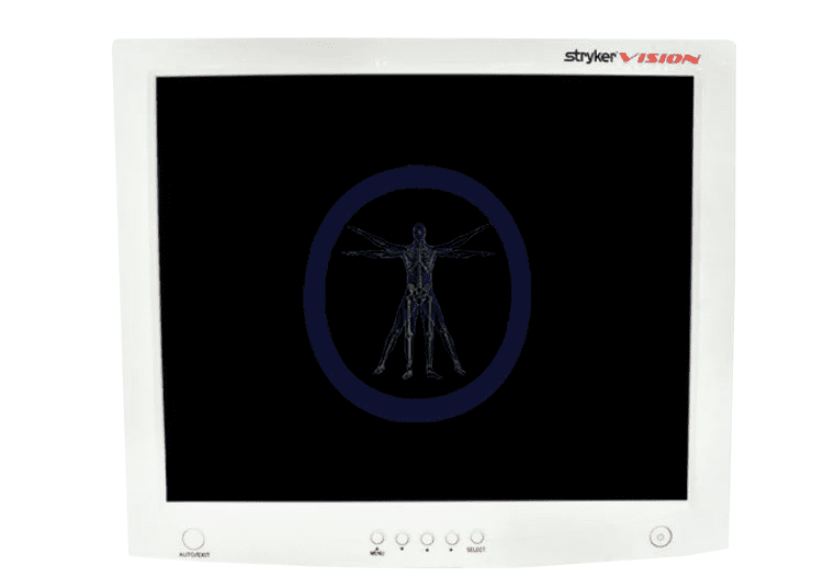 An image of a Stryker-240-030-900 19" Flat Panel Monitor displaying a blue radiographic scan of a human skeleton in a standing pose.