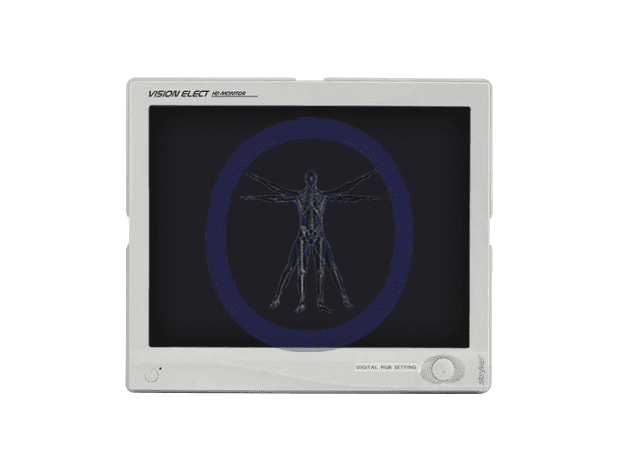 An x-ray image of a human displayed on a Stryker-240-030-930 21″ Vision Elect HD Flat Panel Monitor, showing bones in detail.