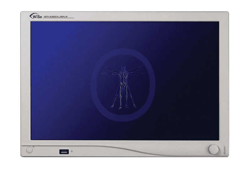 Sentence with product name: X-ray image of a human displayed on a Stryker-240-030-970 26" Wise HDTV Flat Panel Monitor, featuring a clear view of the skeletal structure.